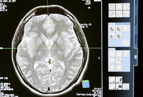 brain scan, x-ray, brain pathways, path